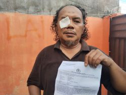 Tak Terima di Beritakan Dugaan KDRT, Seorang Jurnalis dianiaya hingga Lebam dimata